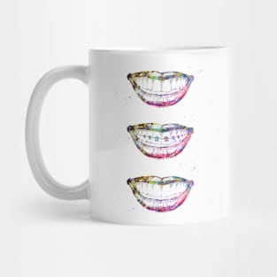 Before, with and after braces Mug